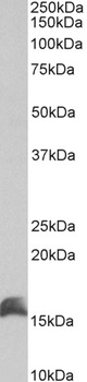 keratin 18 Antibody