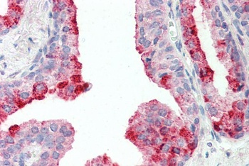 keratin 18 Antibody