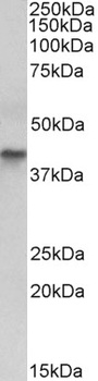 keratin 18 Antibody