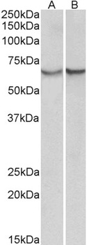 CLIC1/NCC27 Antibody