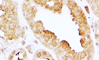 SERCA2/ATP2A2 Antibody