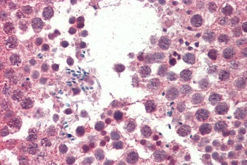 KIT/CD117 Antibody