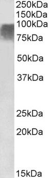 CEBPB Antibody