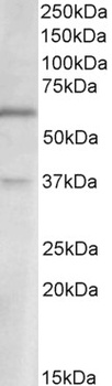 CEBPB Antibody