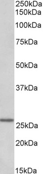 GLP-1-R Antibody
