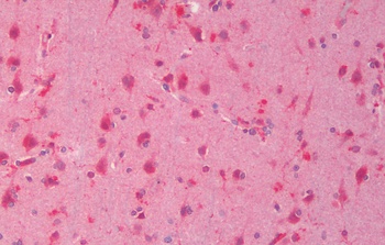 TNNI3 Antibody