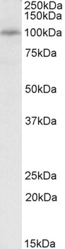 TNNI3 Antibody