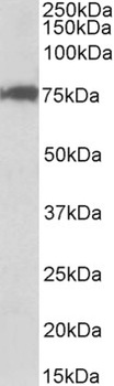 TNNI3 Antibody