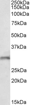 cardiac troponin T Antibody