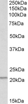 CYP26A1 Antibody