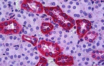 SH2D3A/NSP1 Antibody