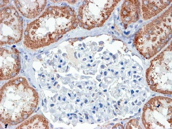 USP16/UBP-M Antibody