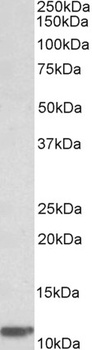 AIMP1 Antibody