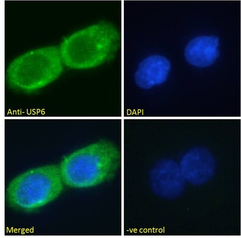 TNFRSF1A Antibody