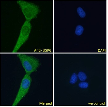 TNFRSF1A Antibody