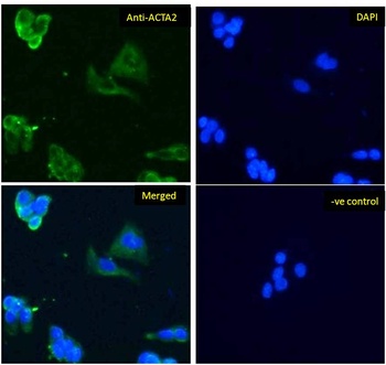 ACTA2 Antibody