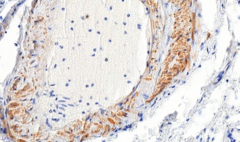 ACTA2 Antibody