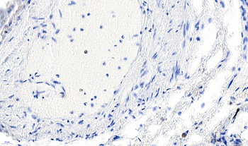 ACTA2 Antibody