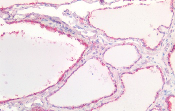 NGFR Antibody