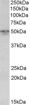 POLDIP2 Antibody