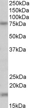 POLDIP2 Antibody