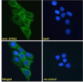 LY6E Antibody