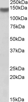 MOBKL3 Antibody