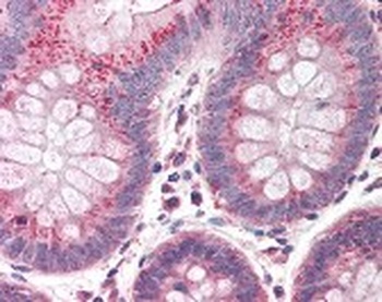 CUL9 Antibody