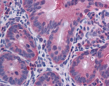 IL10 Antibody