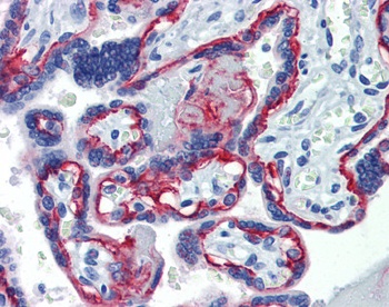 ITGB4 Antibody