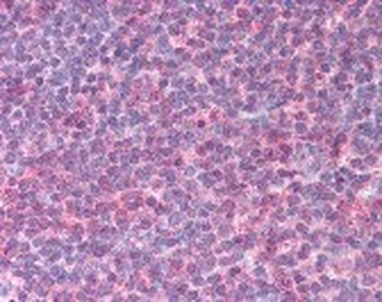 IL6 Antibody
