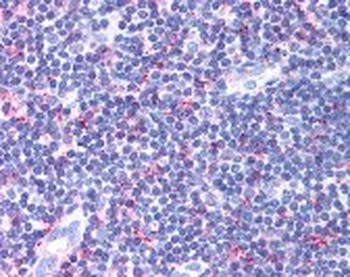 CCR4 Antibody