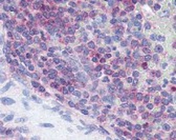 XCR1 Antibody