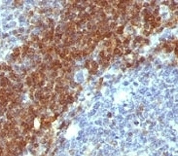 BCL2 Antibody