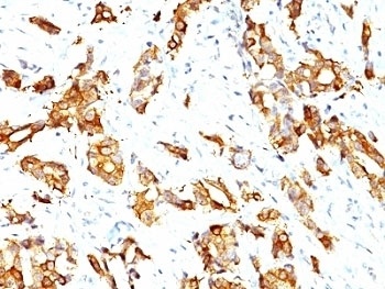 HSPB1 Antibody
