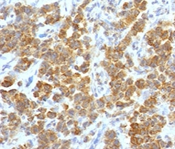 TNFSF15 Antibody
