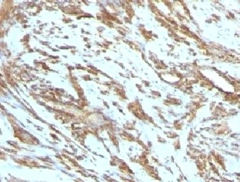 ACTA2 Antibody