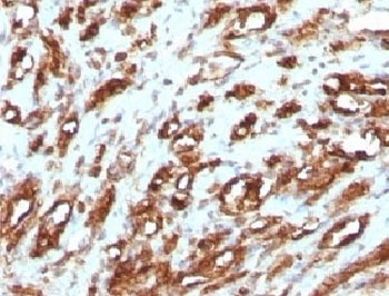 ACTA2 Antibody