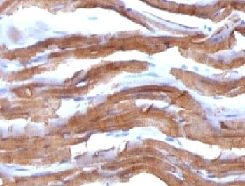 ACTA2 Antibody