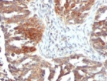 VEGFA Antibody