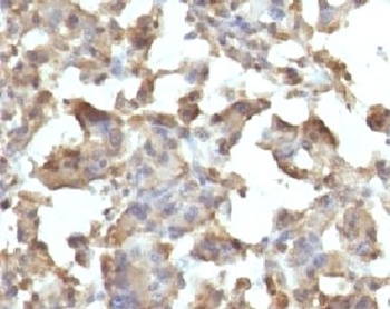 TNF Antibody