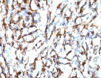 ACTA2 Antibody