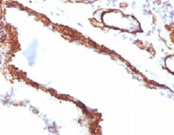 ACTA2 Antibody