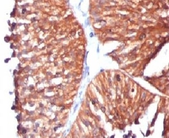 HSPD1 Antibody