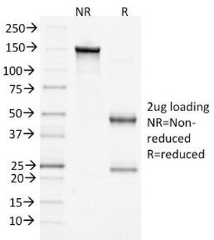 CTNNB1 Antibody