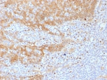 CTNNB1 Antibody