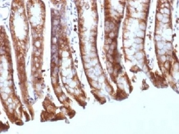 CTNNB1 Antibody