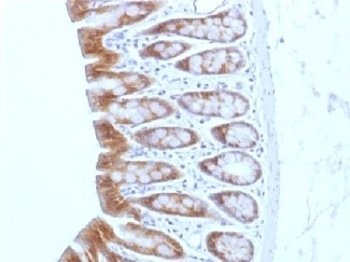 CTNNB1 Antibody