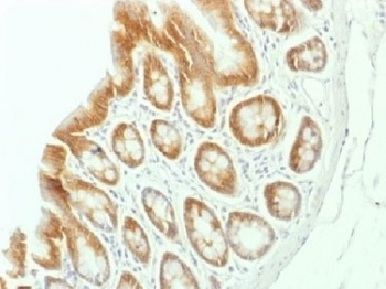 CTNNB1 Antibody