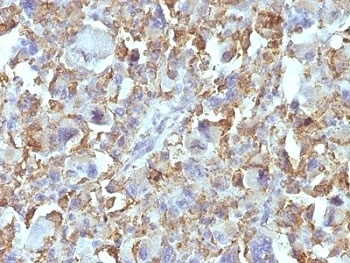 Macrophage / Histiocytoma Marker Antibody [D11]